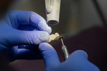 Mersch / LCBG handelt Sozialplan mit Zahnimplantat-Hersteller Anthogyr aus